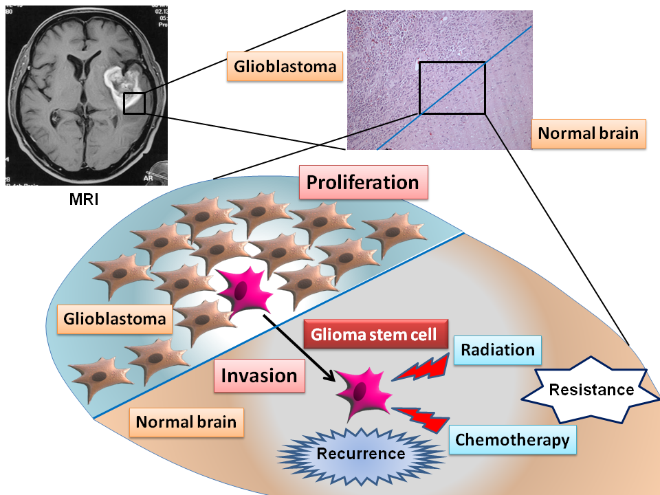 The analysis of glioma stem cell biology