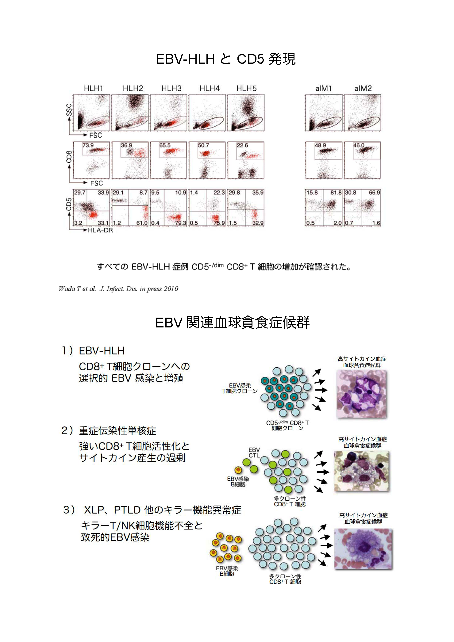EBV感染細胞異常増多症の病態発症機構