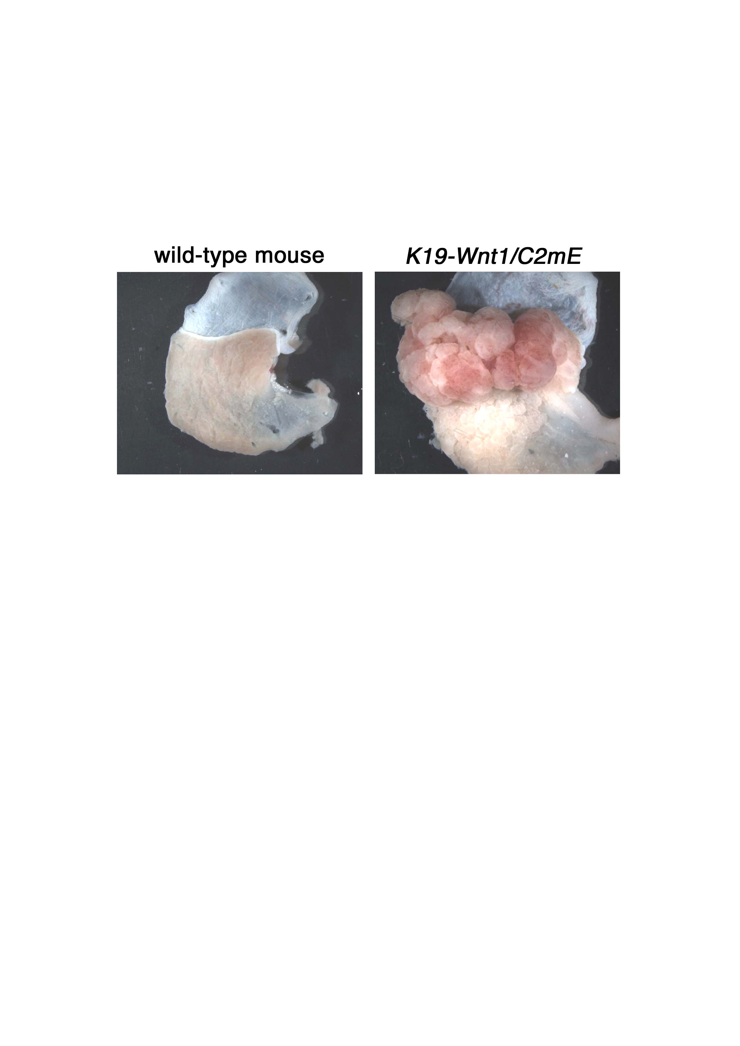 Cooperation of Wnt signaling and COX-2 pathway in gastrointeitinal tumorigenesis